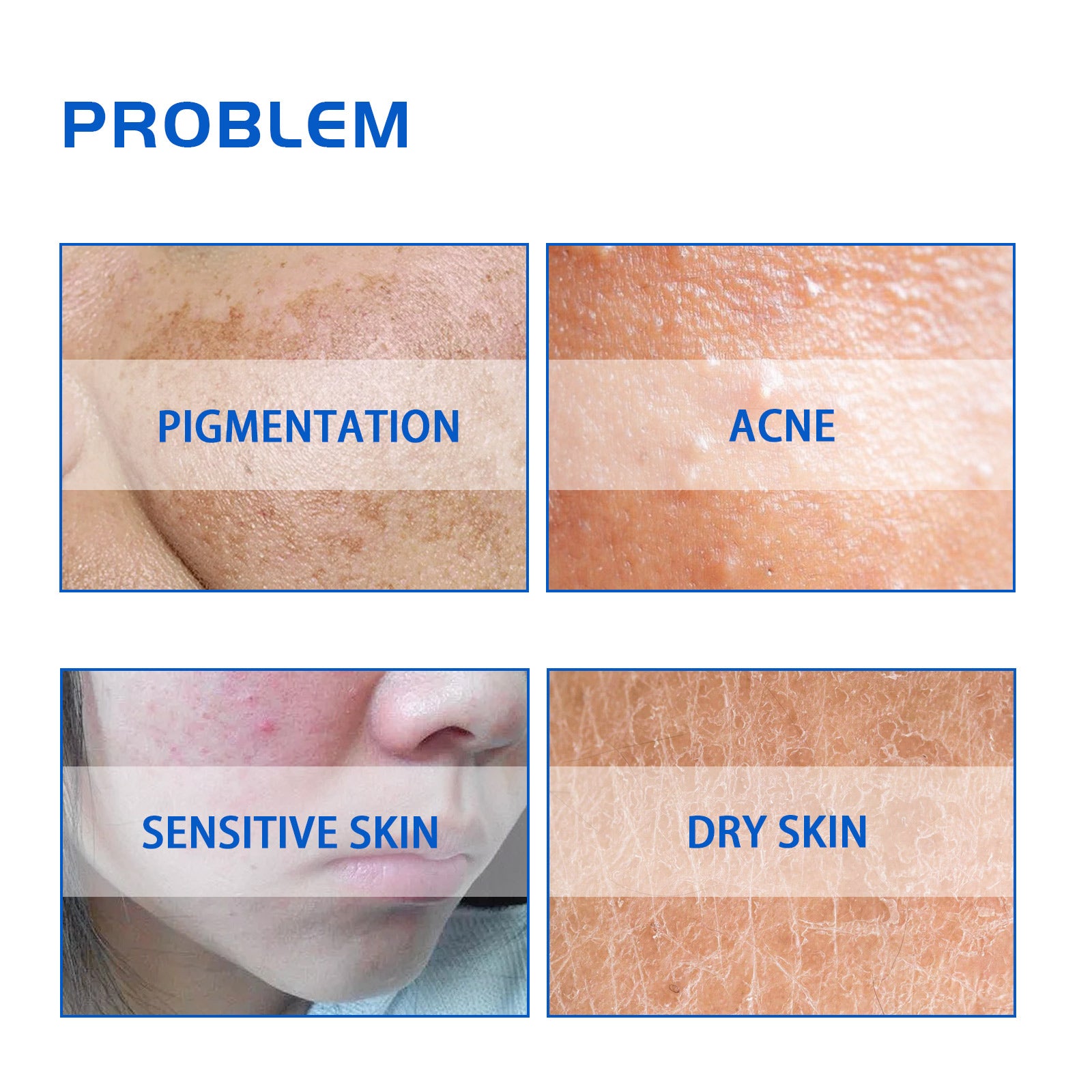 HOYGI Blueberry Facial Care Facial Skin Deep