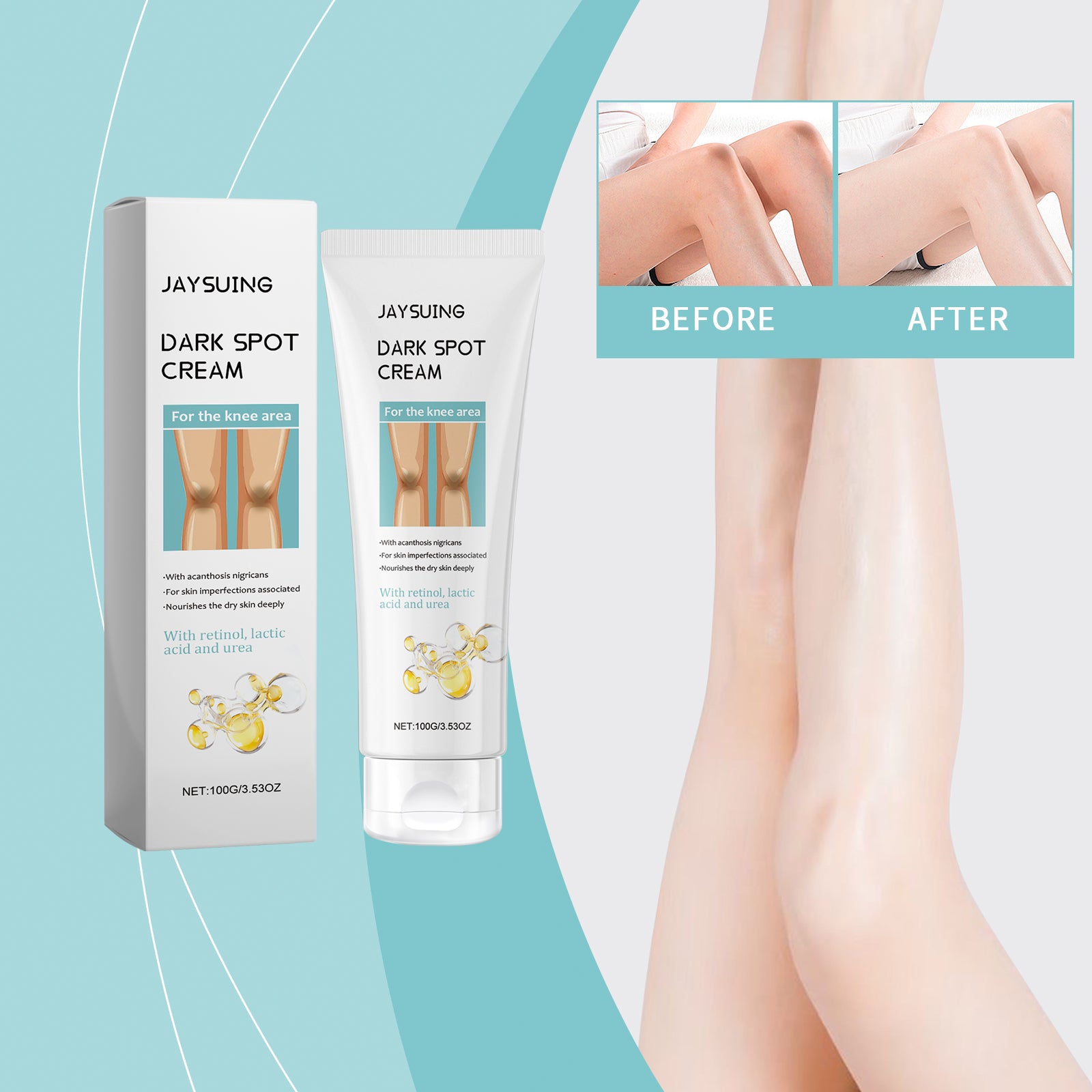 Knee Beauty Cream Knee Skin Massage